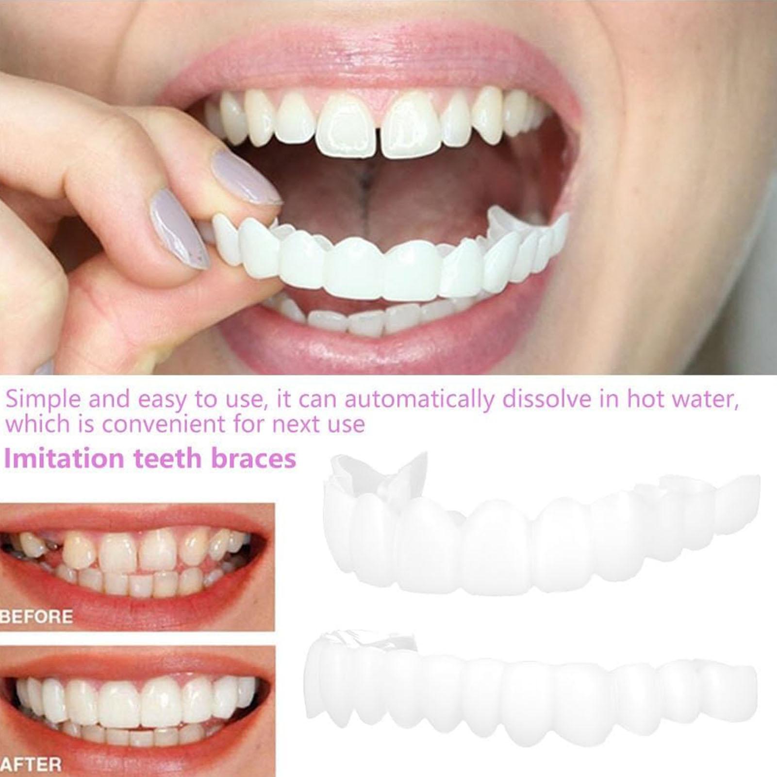 Teeth Whitening Mask - 남녀 공용 임시 치아 베니어 상하악용