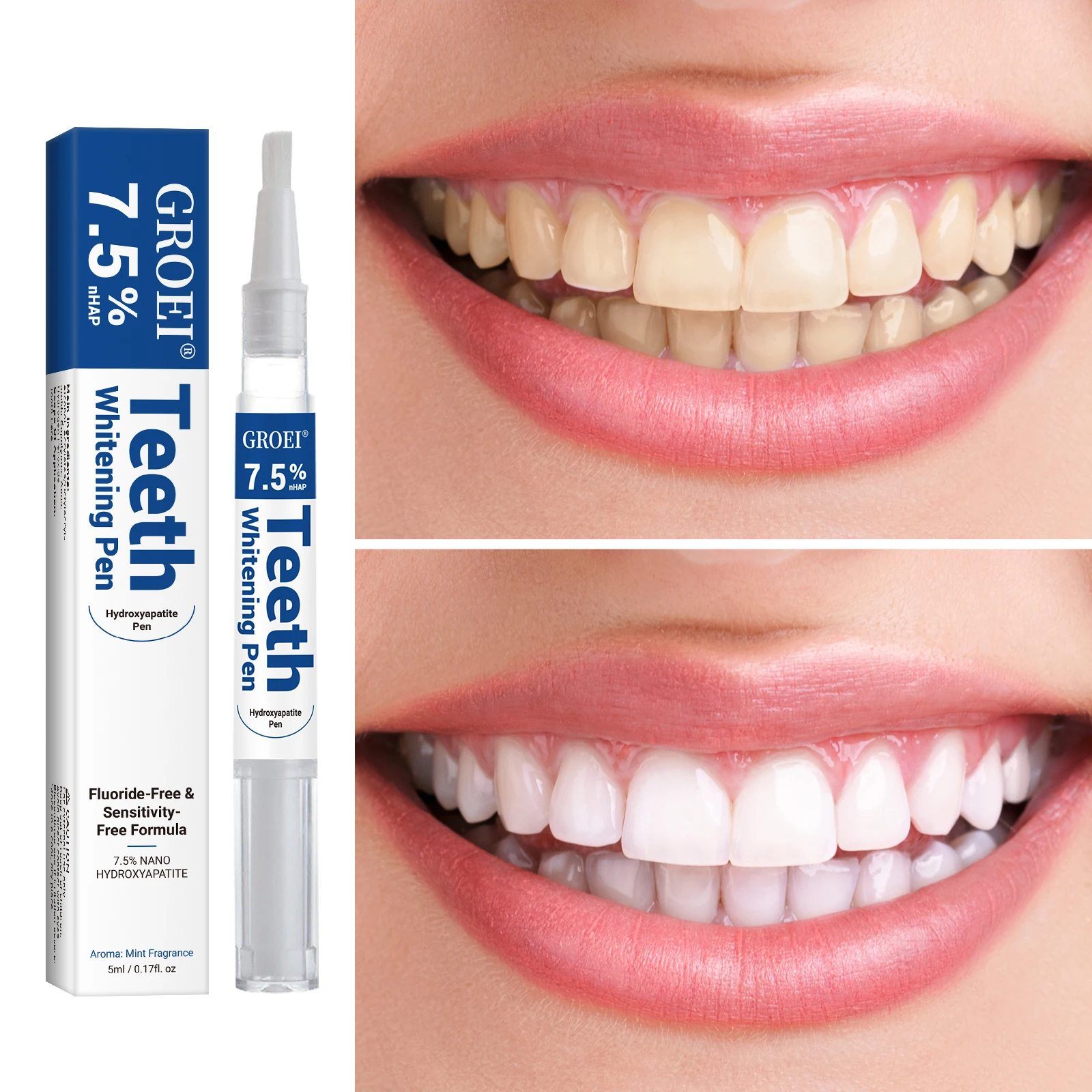 하이드록시아파타이트 치아 미백 펜 눈부신 화이트 얼룩  - Teeth Whitening Results 리뷰 및 가격