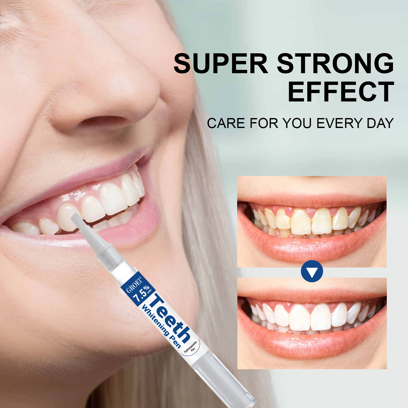 하이드록시아파타이트 치아 미백 펜 눈부신 화이트 얼룩  - Teeth Whitening Results 리뷰 및 가격