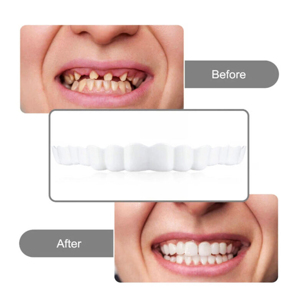 리콘 틀니 세트 임시 교정용 치아 틀니 가짜 치아 구강 - Teeth Whitening Usa 리뷰 및 가격