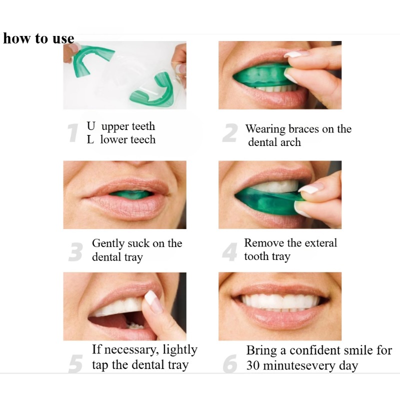 세트 치아 미백 트레이 U 자형 빠른 신선한 호흡 표백 - Teeth Whitening For Trays 리뷰 및 가격