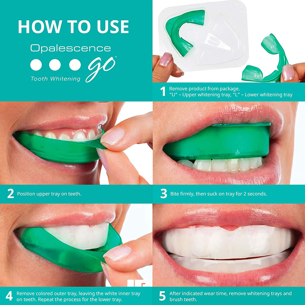 치아 미백용 과산화 수소, 유백광 고 프리필 트레이,  - Teeth Whitening For Trays 리뷰 및 가격