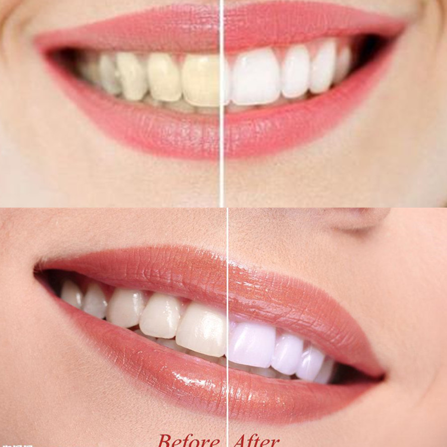 대나무 숯 치아 치아 Dentis Lab 구강 위생 관 - Teeth Whitening Charcoal Powder 리뷰 및 가격