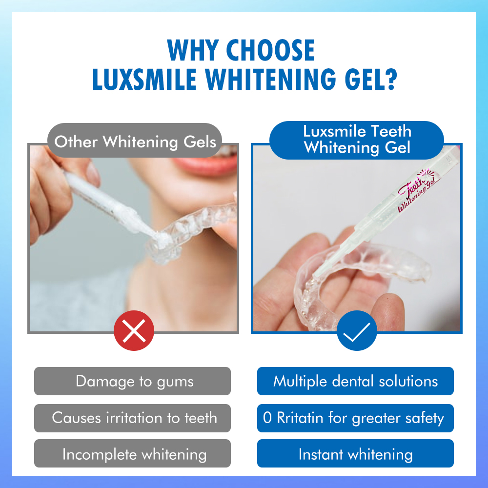 치아 미백 젤 PAP 또는 35%CP 치아 미백 젤 구 - Teeth Whitening Results 리뷰 및 가격