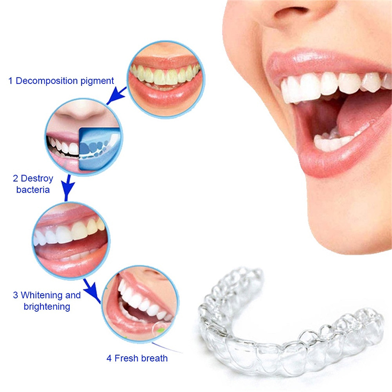 컴포트핏 실리콘 마우스 트레이 야간 치아 보호대 (이갈 - Teeth Whitening For Trays 리뷰 및 가격