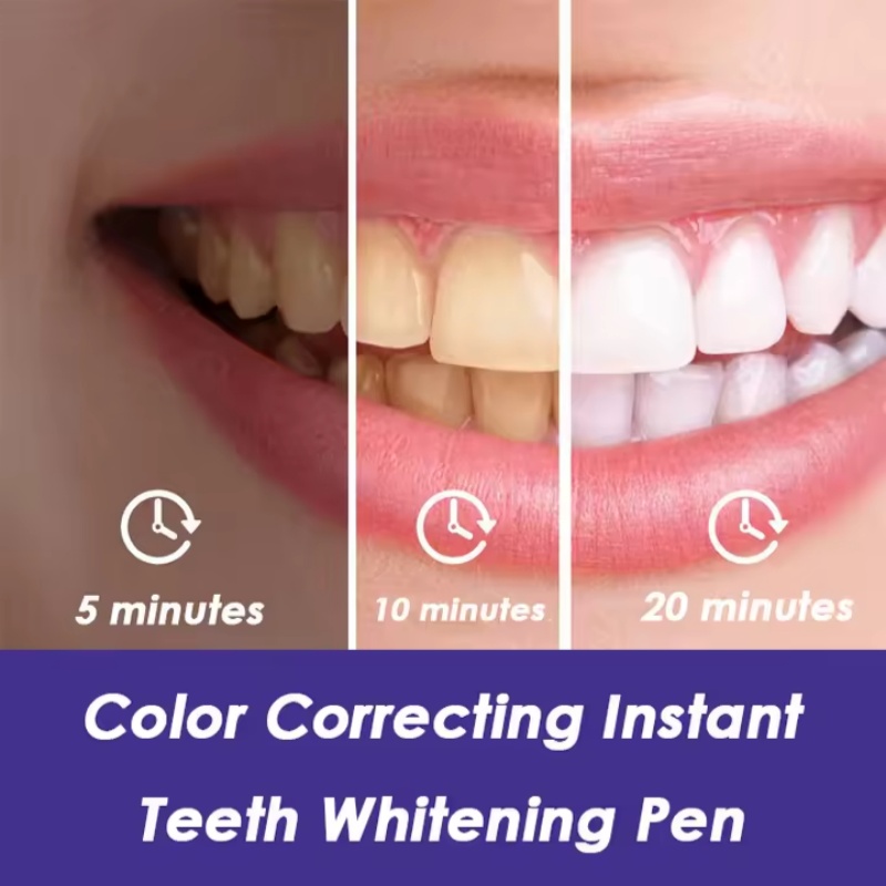 마법의 보라색 치아 미백 펜 신선한 호흡 얼룩 제거 치 - Teeth Whitening Gel Pen 리뷰 및 가격