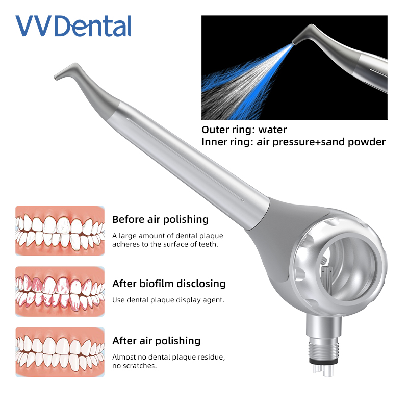 VV 치과용 2/4홀 치아 미백 샌드블라스팅 건 양면  - Teeth Whitening Usa 리뷰 및 가격