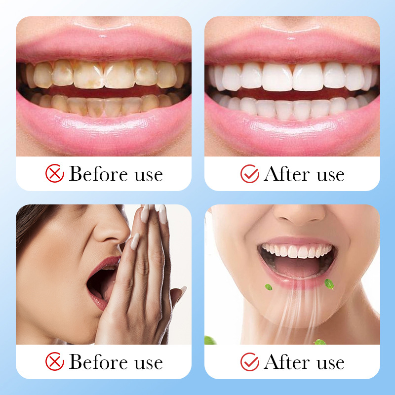 대나무 숯 활성탄 미백 치아 미백 파우더 치아 청소 구 - Teeth Whitening Charcoal Powder 리뷰 및 가격