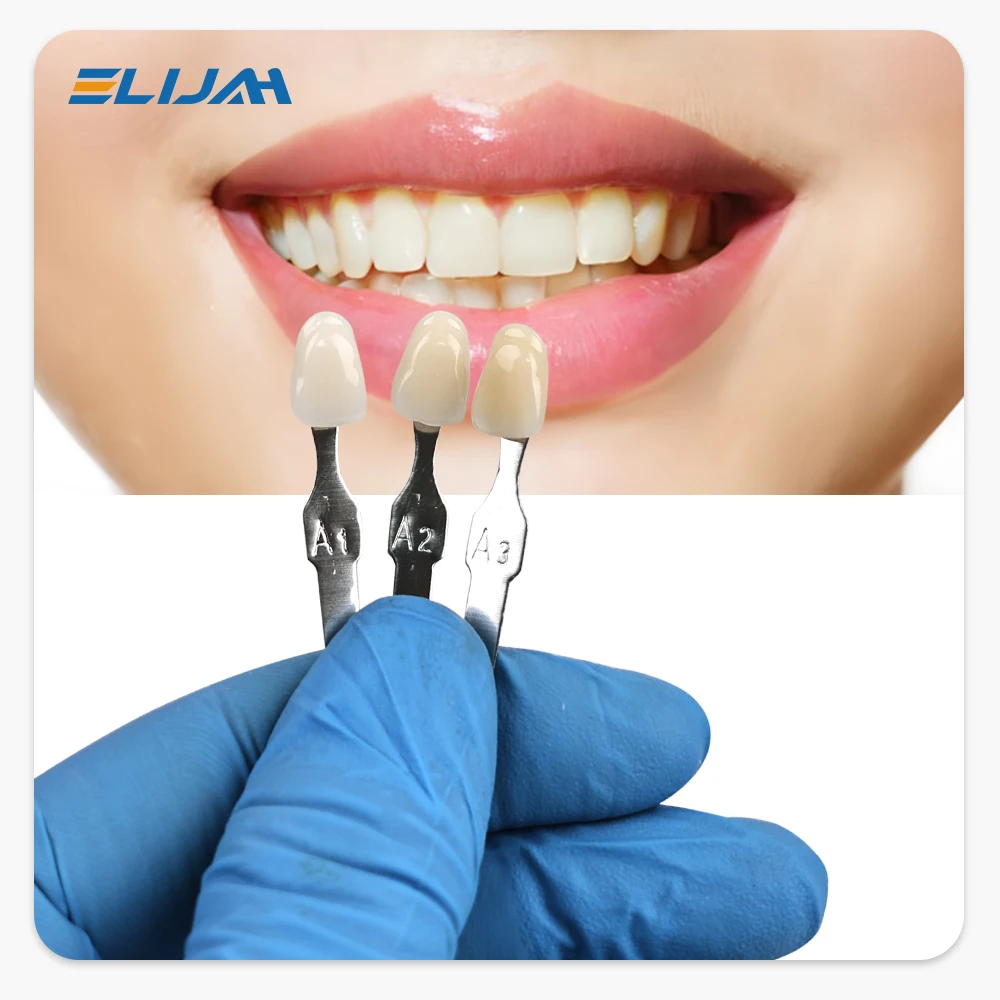 엘리야 마스터 치아 미백 색상표 16색 치아 미백 비교 - Teeth Whitening/Bleaching 리뷰 및 가격