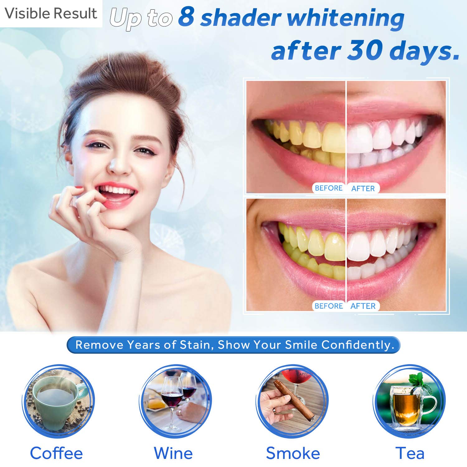 치아 미백 젤 리필 주사기 치아 미백 젤 인비스알라인  - Teeth Whitening Results 리뷰 및 가격