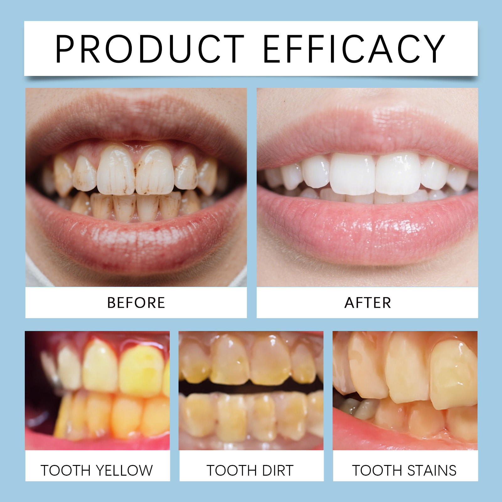 페이무코 8ml 치아 젤 펜 순한 딥 클린 광택 치아  - Teeth Whitening Gel Pen 리뷰 및 가격