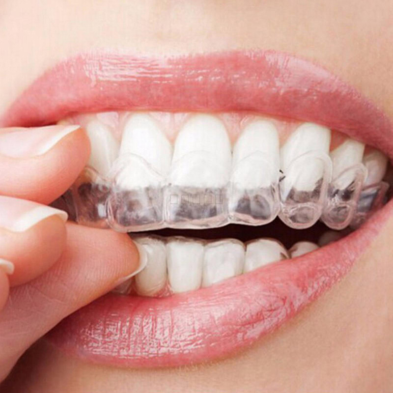 투명 열 성형 치아 미백 트레이, 치과 치아, 치과 장 - Teeth Whitening For Trays 리뷰 및 가격