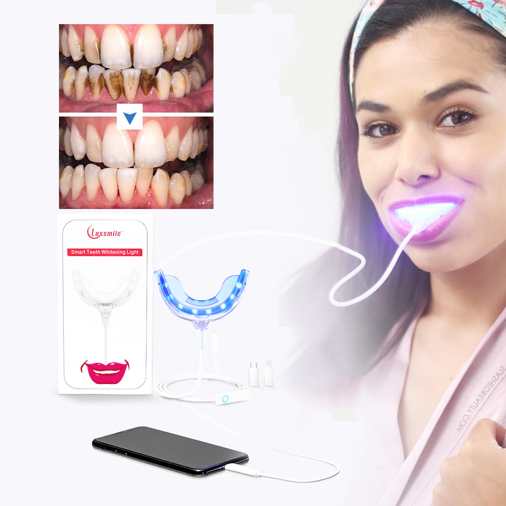Luxsmile 스마트 LED 치아 미백 휴대용 USB - Teeth Whitening Gel Pen 리뷰 및 가격
