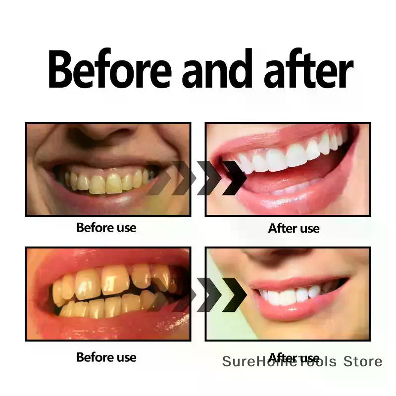 치아용 대나무 숯가루 천연 미백 제품 얼룩 제거 구강  - Teeth Whitening Charcoal Powder 리뷰 및 가격