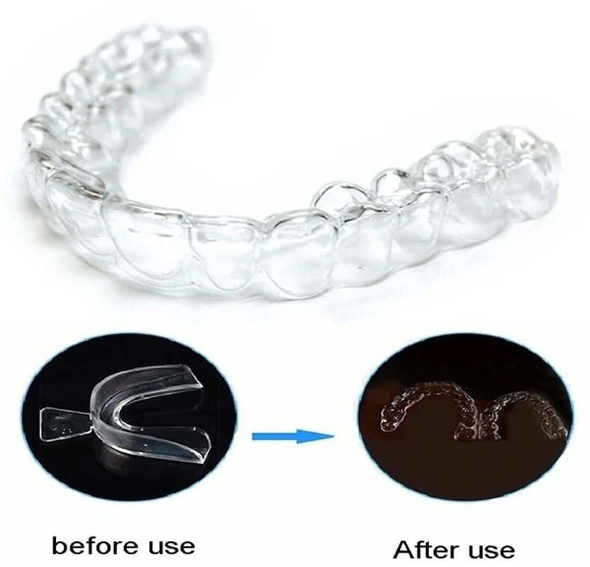 안티 코골이 Bruxism 슬리핑 입 가드 나이트 가드 - Teeth Whitening Mask 리뷰 및 가격