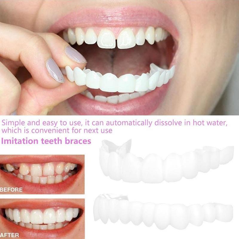 스냅온 치아 베니어, 즉각적인 실리콘 스마일 베니어,  - Teeth Whitening Mask 리뷰 및 가격