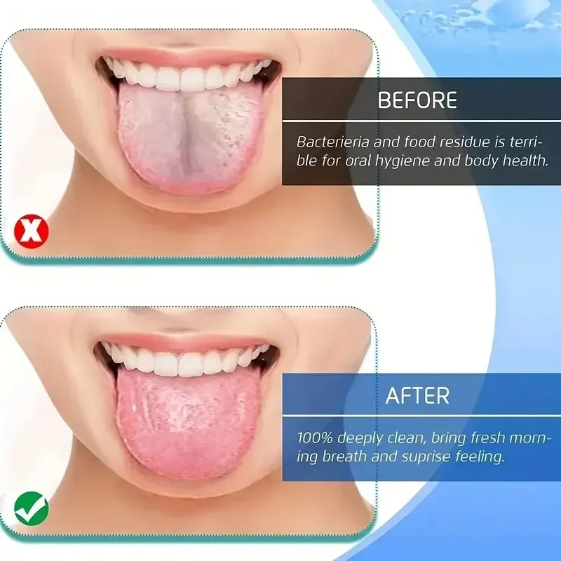 호흡 개선 혀 클리너, 코팅 칫솔, 금속 재질, 신선한 - Tongue Scraper Metal 리뷰 및 가격