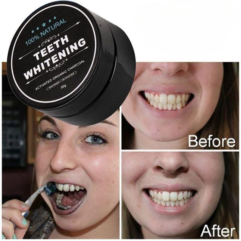 활성탄 치아 미백 파우더 1박스, 숯 치아 클리닝 파우 - Teeth Whitening Charcoal Powder 리뷰 및 가격