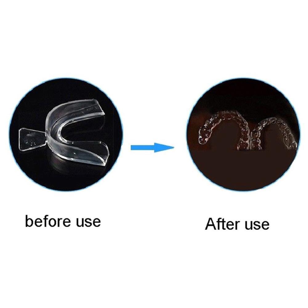 실리콘 마우스가드 교정용 치아 유지 장치 치아 보호대  - Teeth Whitening For Trays 리뷰 및 가격