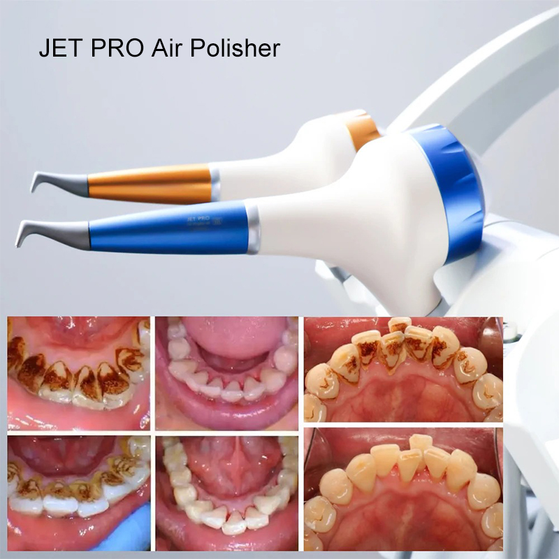 VV 치과용 에어폴리싱 프로피 에어 플로우 구강 위생  - Teeth Whitening Usa 리뷰 및 가격