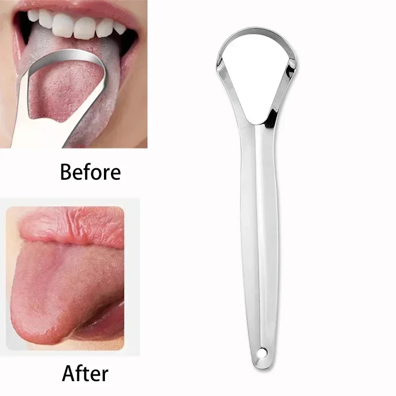 구취증 치석 제거기 스테인리스 스틸 세척 제거기 혀 코 - Tongue Scraper Metal 리뷰 및 가격