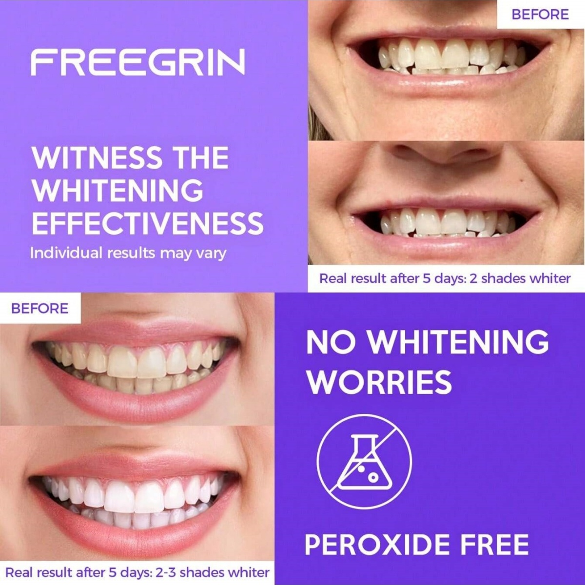 디럭스 화이트닝 치아 스티커 7/14/21 쌍 젤 화이 - Teeth Whitening Gels Used By Dentists 리뷰 및 가격