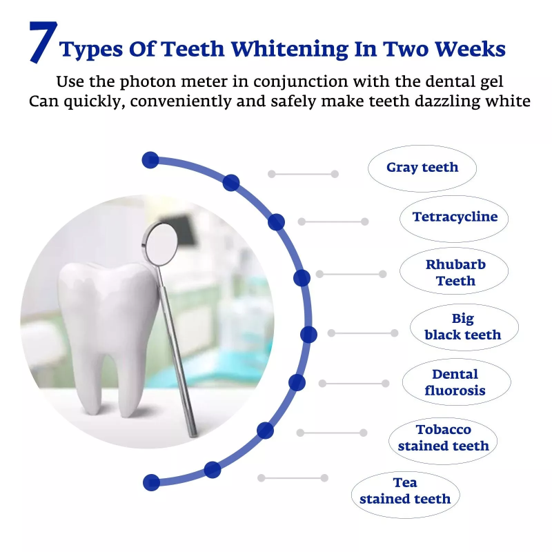 치아 미백 가속기 스마트 LED 블루 라이트 휴대용 U - Teeth Whitening For Trays 리뷰 및 가격