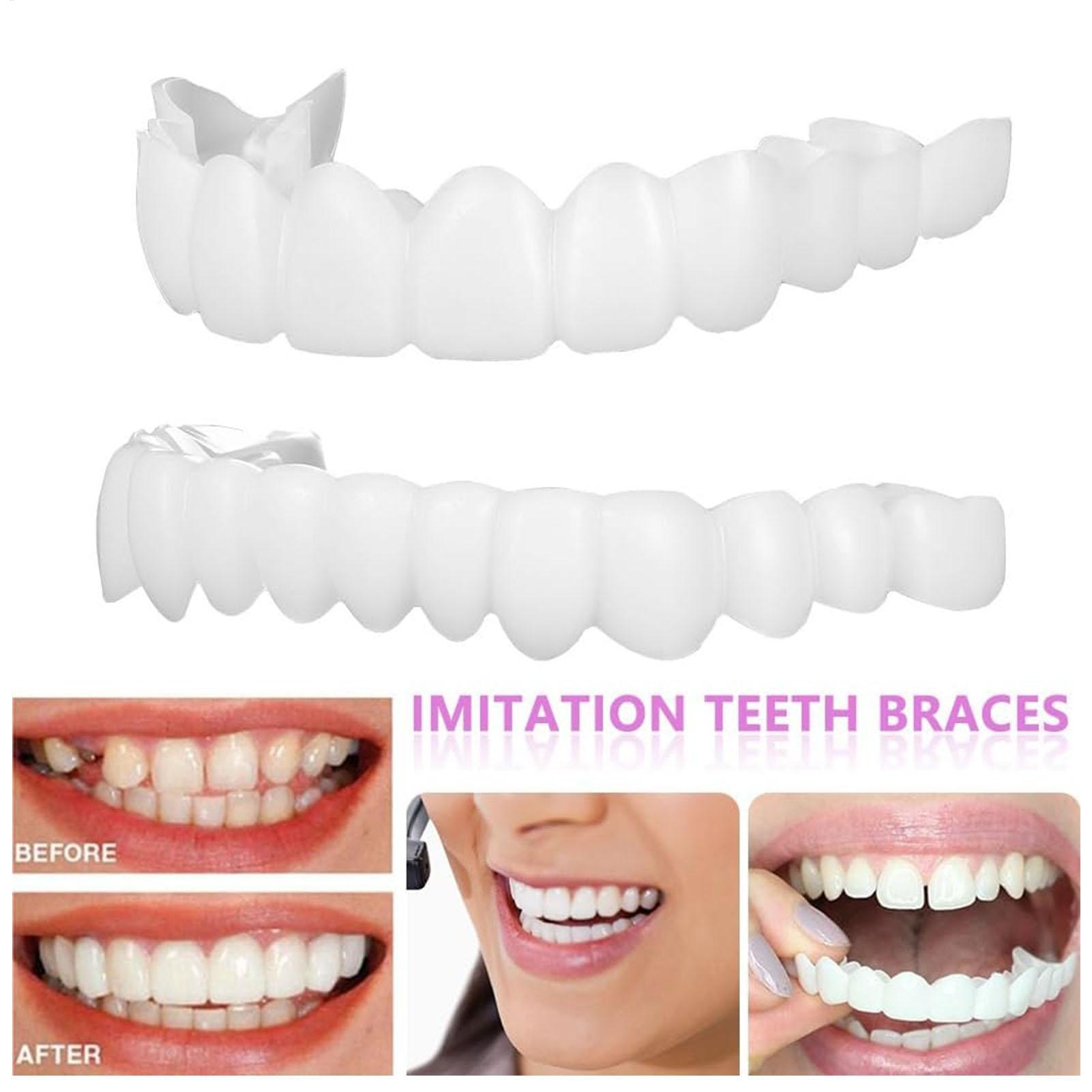 남녀 공용 임시 치아 베니어 상하악용 임시 미소 개선기 - Teeth Whitening Mask 리뷰 및 가격