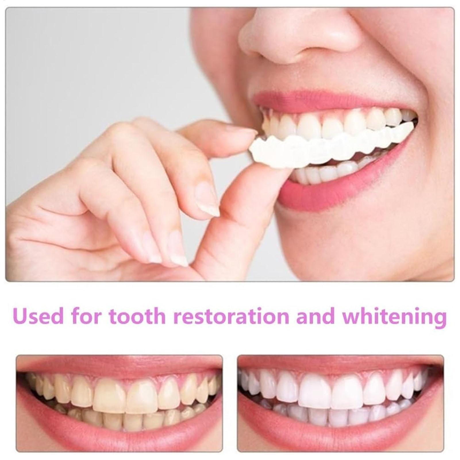 남녀 공용 임시 치아 베니어 상하악용 임시 미소 개선기 - Teeth Whitening Mask 리뷰 및 가격