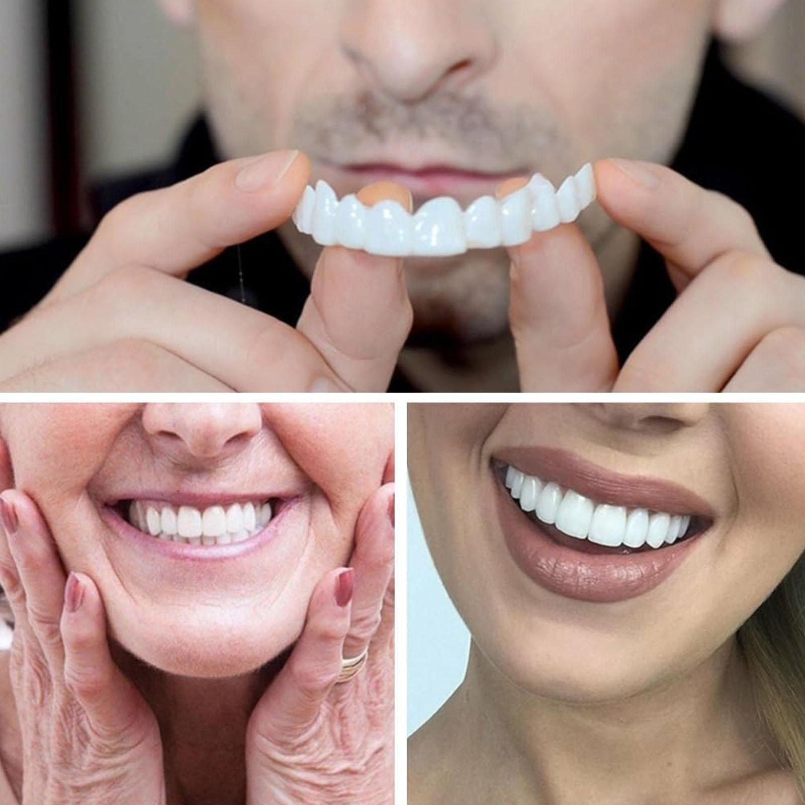 남녀 공용 임시 치아 베니어 상하악용 임시 미소 개선기 - Teeth Whitening Mask 리뷰 및 가격