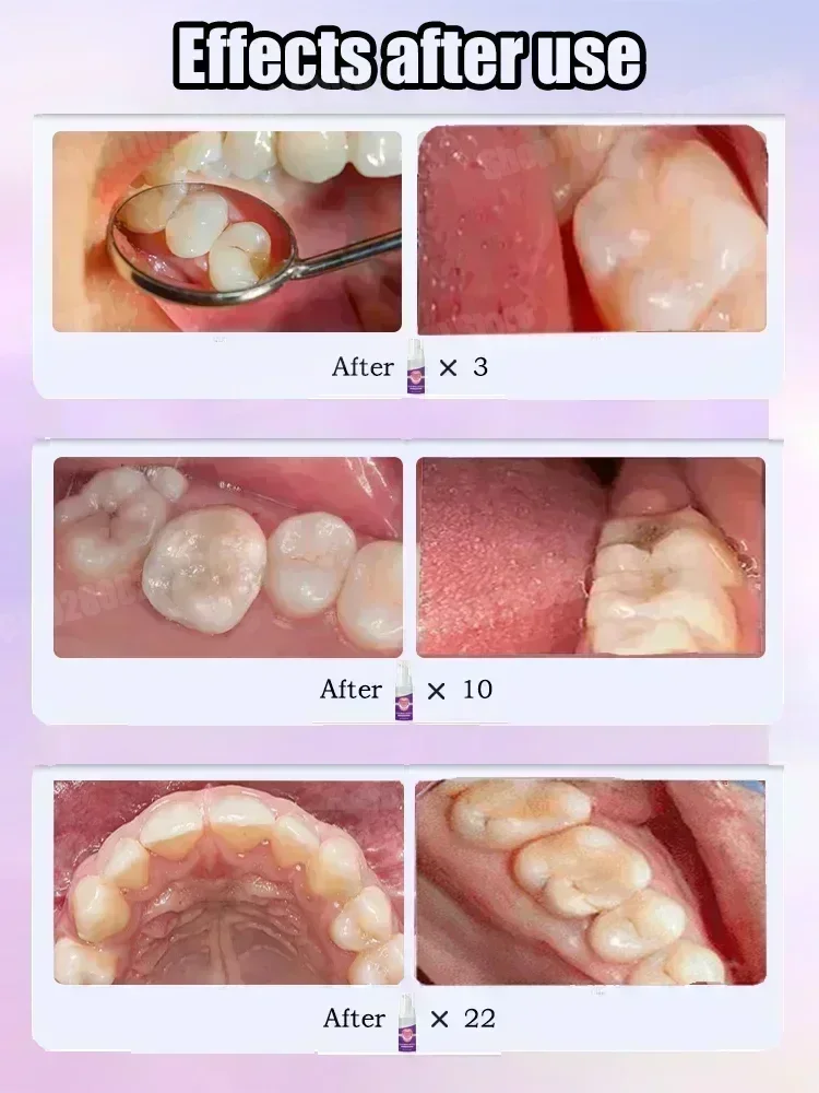 치아 청소 치약은 치아 얼룩을 제거합니다. 치아 미백  - Teeth Whitening Charcoal Powder 리뷰 및 가격