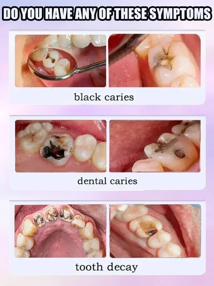 치아 청소 치약은 치아 얼룩을 제거합니다. 치아 미백  - Teeth Whitening Charcoal Powder 리뷰 및 가격
