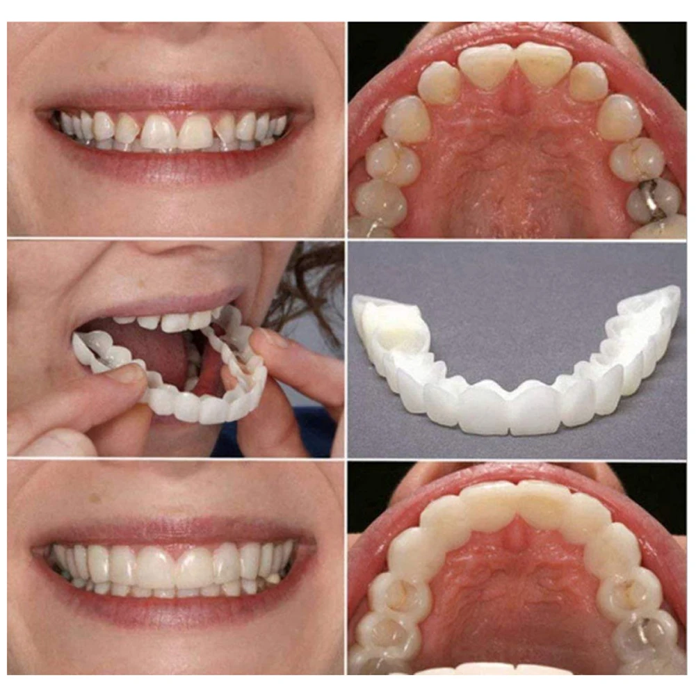 남녀공용 미백 대체 스마일 스냅 치아, 편안한 상하 턱 - Teeth Whitening Mask 리뷰 및 가격